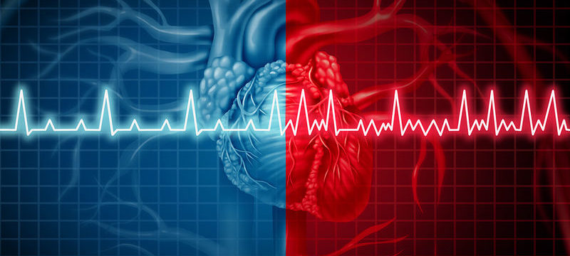 κολπική μαρμαρυγή