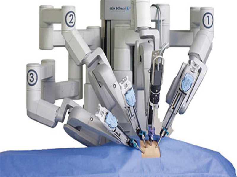 Ρομποτική χειρουργική: Επεμβάσεις με Η/Υ για ταχεία ανάρρωση και ελάχιστο πόνο