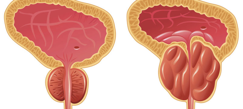 8705F126-0CC7-43DC-A3AA-2BBA1B4B263B