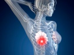 85BE7258-DF22-46CD-8B2E-09EF4459A1E9