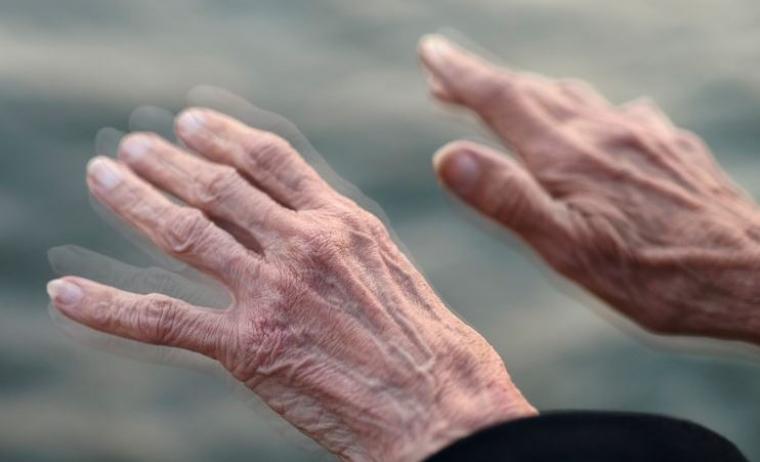 Το Πάρκινσον ξεκινά από…το έντερο.