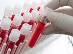 DE5F6133-7511-4330-9FD7-E878E0D940C9