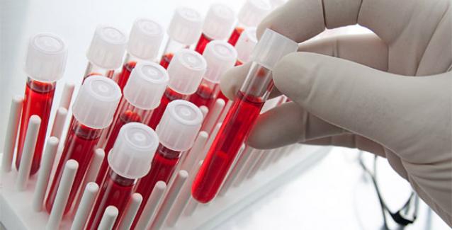 DE5F6133-7511-4330-9FD7-E878E0D940C9