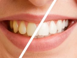 79EB847E-2D97-4F87-A1C4-D1A4C06AAD68