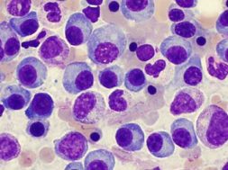 DB3D6A18-E71D-4789-B999-5BD150BF43B2