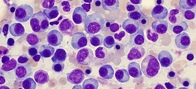 Το ερευνητικό έργο του ΕΚΠΑ παρουσιάστηκε σε παγκόσμιο συνέδριο για το πολλαπλούν μυέλωμα