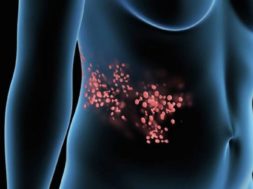 663F826D-7E44-4A44-A049-9FCC17AC12A3