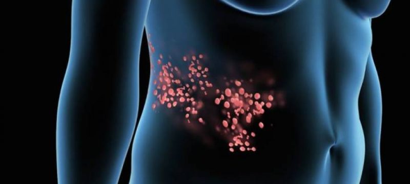 663F826D-7E44-4A44-A049-9FCC17AC12A3