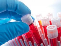 1450fe47fc6d3f93ff072c134eaeda35_XL