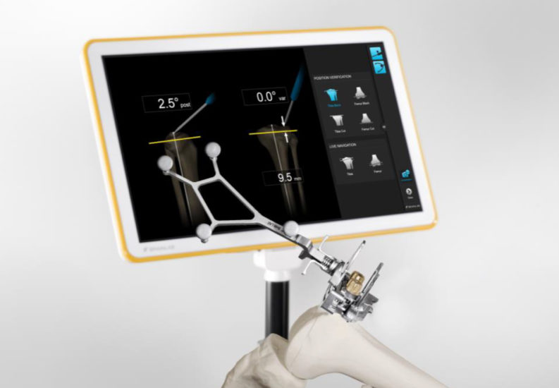 Πρωτοποριακό σύστημα ρομποτικής πλοήγησης στην Ευρωκλινική Αθηνών