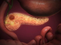 83061014-9C4E-448F-8292-ADFB75ACF665