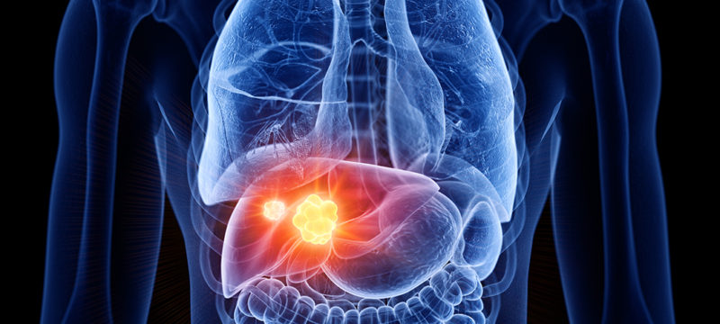 707DA357-AE91-4E3E-85D3-A1F51FDBB6F0