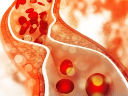 CB9D8205-24E3-44A6-A562-96FE5BD74E81