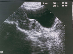 D5D1E0E6-F9E6-473C-9DC2-A944B4A686EA