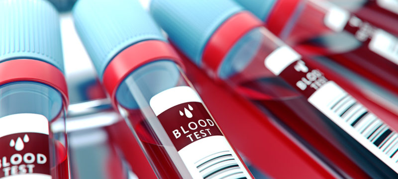 Lab equipment centrifuging blood. Concept image of a blood test.3d rendering.