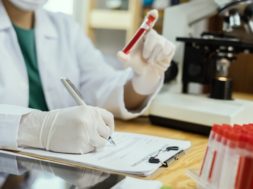 1FECD119-8850-446D-B660-D75406C741CA