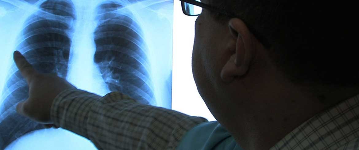 Συμφωνία Ε.Χ.Ε.Μ. και Ε.Ο.Π.Ε. για το ρόλο της προεγχειρητικής θεραπείας στον καρκίνο του μαστού