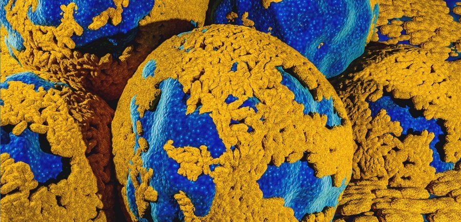 wwf: Υπερεκμετάλλευση της γης και πανδημίες