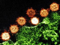 5CB702B3-1D3C-41ED-B093-ABC1A821005D