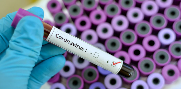 Coronavirus positive