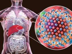 ABEADE17-5878-45D9-B2AE-1594712FDD2B