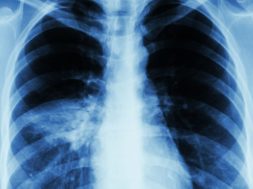 E2A0A0B1-40CB-43FF-9671-48C1B3B88073