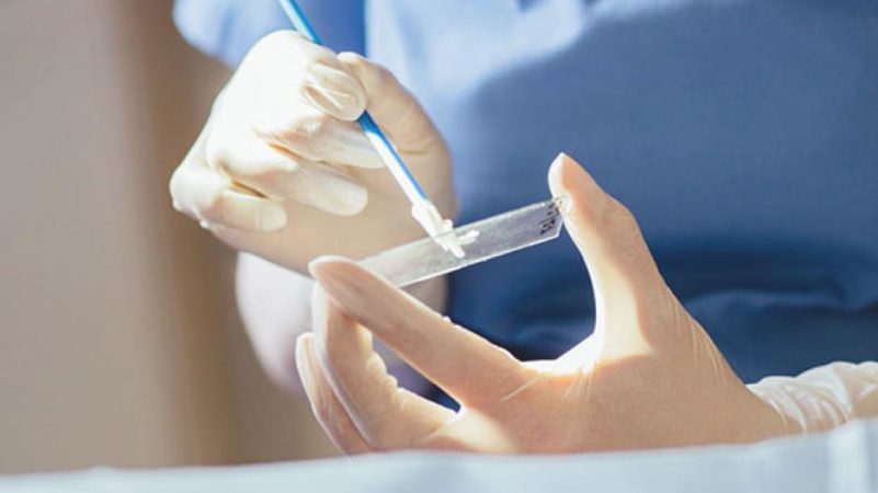 Δήμος Κορδελιού-Ευόσμου: Δωρεάν τεστ Pap