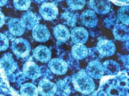 A33828EE-9555-4091-A697-5388D7993C9A