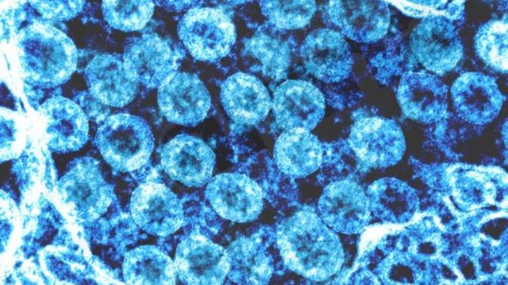 Δέκα νέα επιβεβαιωμένα κρούσματα κορωνοϊού στη χώρα μας