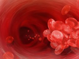 blood_thrombosis23