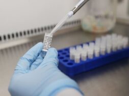 Outbreak of the coronavirus disease (COVID-19) in Keele