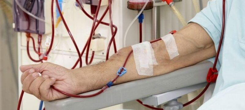 blood-dialysis-620×330-1467141377