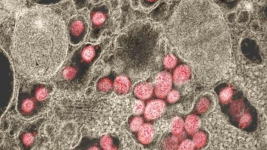 Κορωνοϊός: Θα πρέπει να σκεφθούμε το κλείσιμο των συνόρων