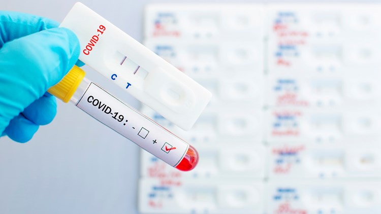 Το «ΜΗΤΕΡΑ» δημιουργεί την υπηρεσία Drive-Through COVID-19 test.