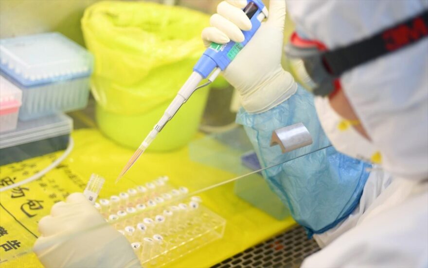 Η ανοσιακή απάντηση έναντι του SARS-CoV-2 ποικίλλει σημαντικά μεταξύ ασθενών με ήπια νόσο COVID-19