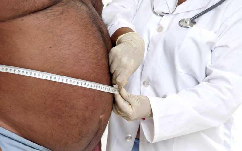 Συνάντηση Κοντοζαμάνη με την ΕΙΕΠ για τα χρονίζοντα θέματα σχετικά με την παχυσαρκία