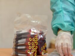 Italy Coronavirus Cases Slightly Drop After Weeks Of Lockdown