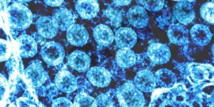 D9E19277-2FFA-40A4-9074-F1C42B46A574