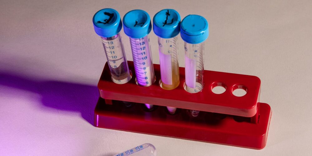 Προς καθολικό lockdown η Μεγάλη Βρετανία