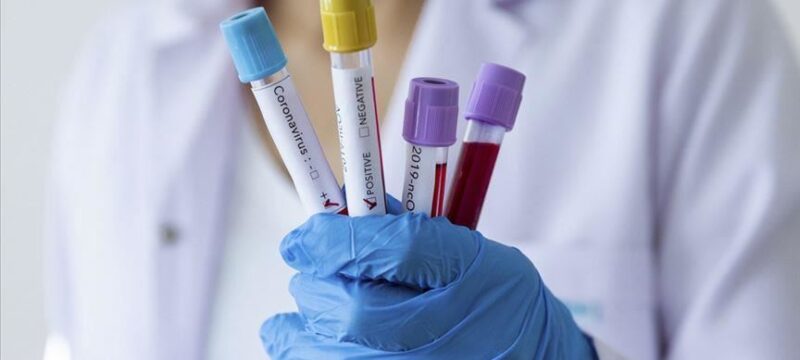 29B805A7-F473-4092-A38F-39D6FD66F3E4