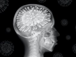 6154133A-E8E4-41B4-91ED-5756DF322EE0