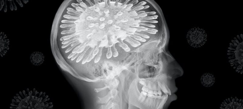 6154133A-E8E4-41B4-91ED-5756DF322EE0