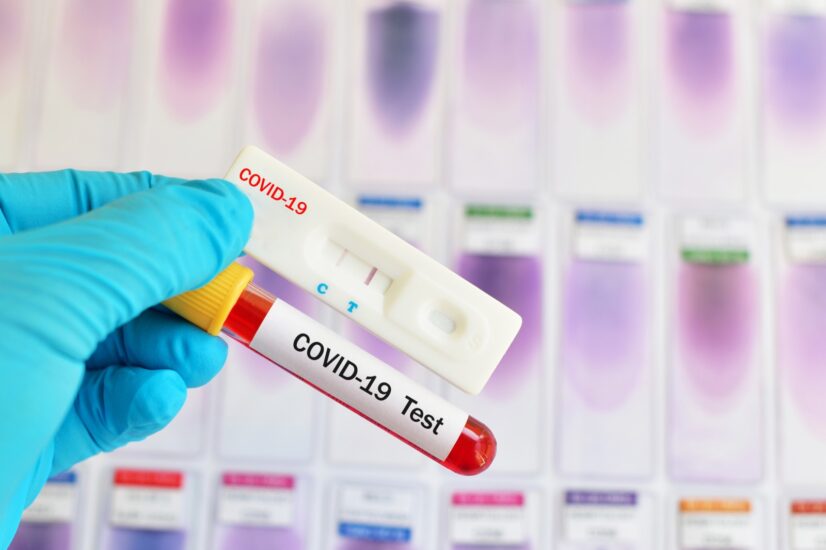 Κορωνοϊός και Rapid Test στην Αττική