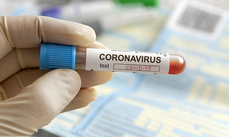 Γρήγορο τεστ προβλέπει ποιοι ασθενείς με κορωνοϊό κινδυνεύουν περισσότερο