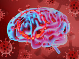 847082F9-FCAF-41E2-A06A-8B4BA92DE6D5