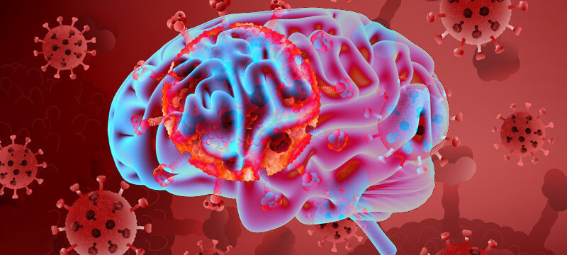 847082F9-FCAF-41E2-A06A-8B4BA92DE6D5