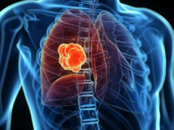 8D5E0FB5-AECA-41F0-9D0E-E90AA3EA1314