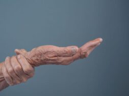 Elderly women with pain.