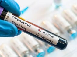 hand-holding-testing-patients-blood-samples-coronavirus-outbreak-covid-laboratory-new-coronavirus-ncov_207254-5