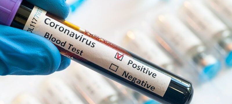 hand-holding-testing-patients-blood-samples-coronavirus-outbreak-covid-laboratory-new-coronavirus-ncov_207254-5